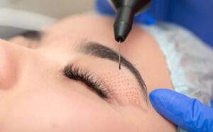 How Many Times Can You Have Eyelid Surgery?