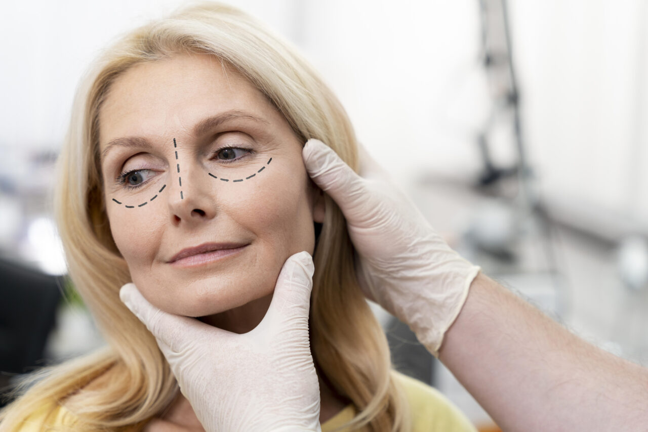 What Is A Mini Facelift? Dr. Amir Sadri