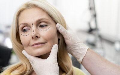 What Is A Mini Facelift?