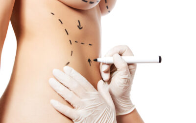 Why is plastic surgery so popular?