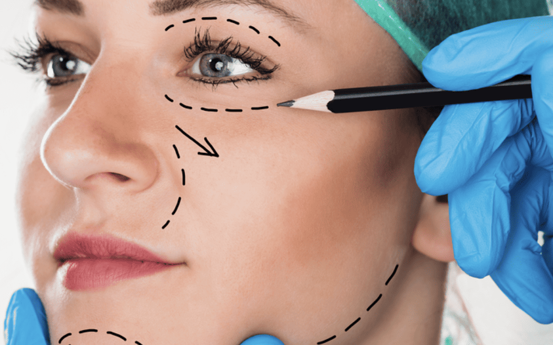 5 Surprising Benefits of Getting a Facelift