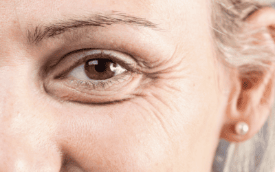 Is Eyelid Surgery Worth It? The Benefits of Eyelid Surgery