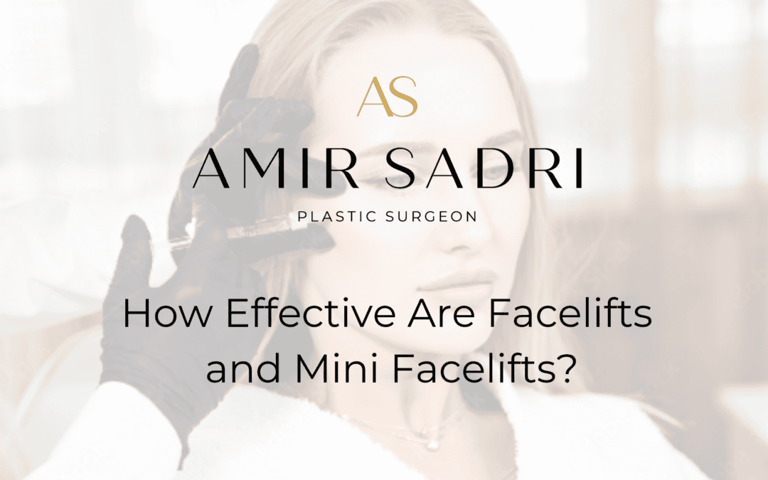 How Effective Are Facelifts and Mini Facelifts?