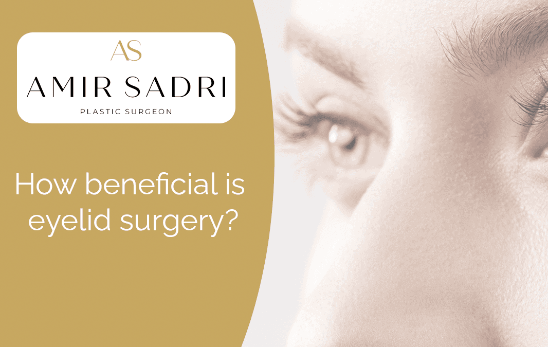 How beneficial is eyelid surgery?