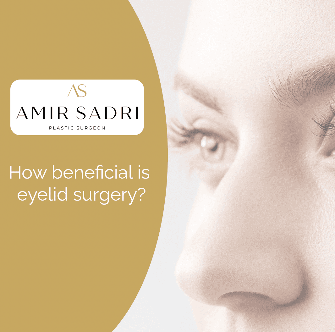 How beneficial is eyelid surgery?