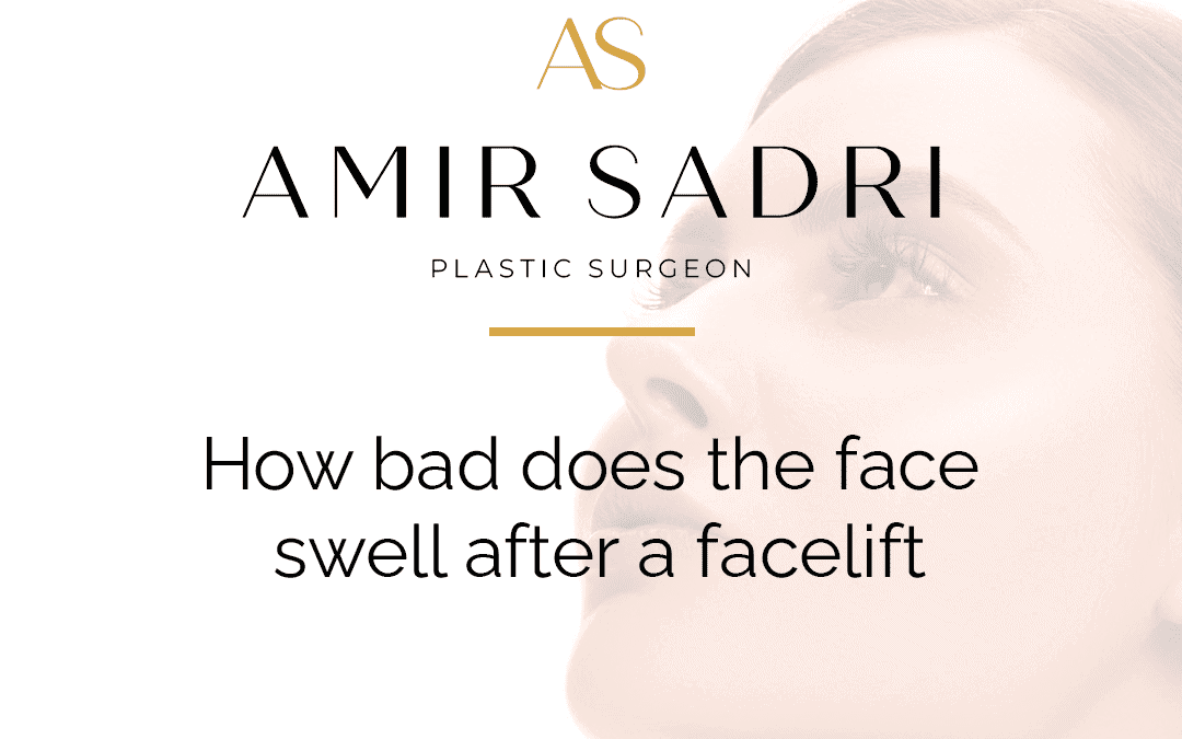 How Bad Does the Face Swell After a Facelift?