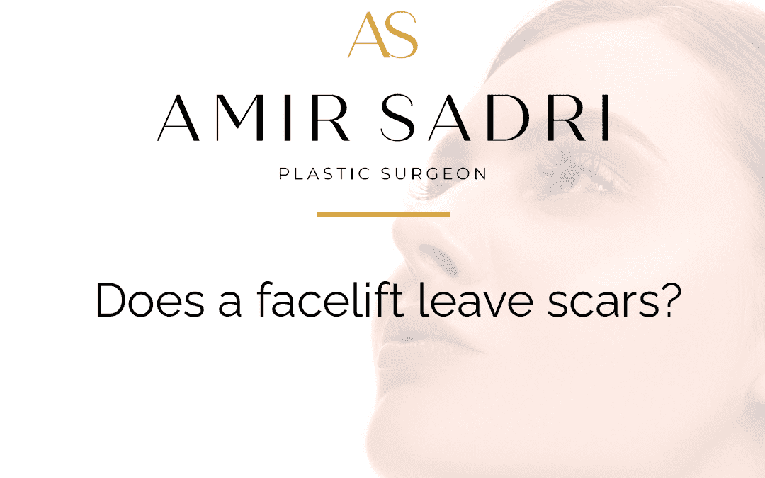 Does a Facelift Leave Scars?