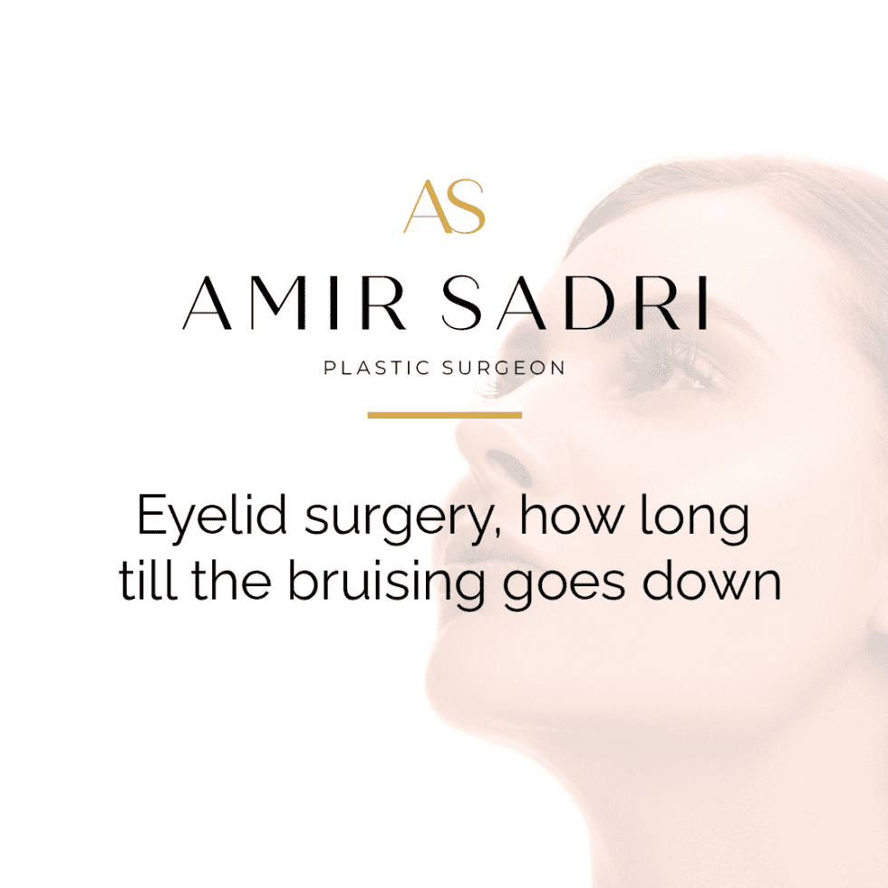 Eyelid Surgery How Long Till The Bruising Goes Down Dr Amir Sadri