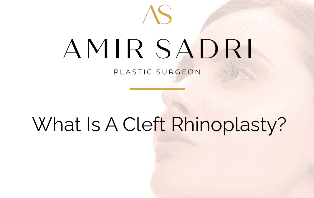 What Is A Cleft Rhinoplasty