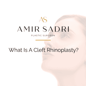 what is a cleft rhinoplasty