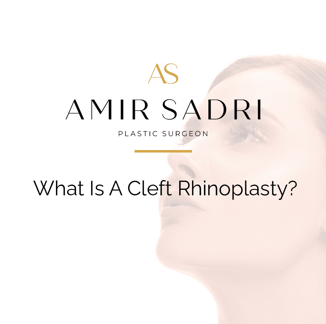 what is a cleft rhinoplasty