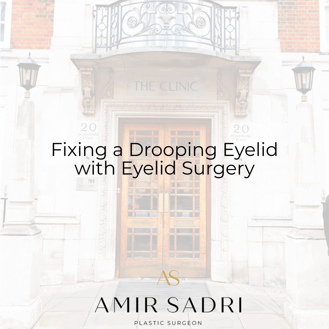 Fixing a drooping eyelid with eyelid surgery