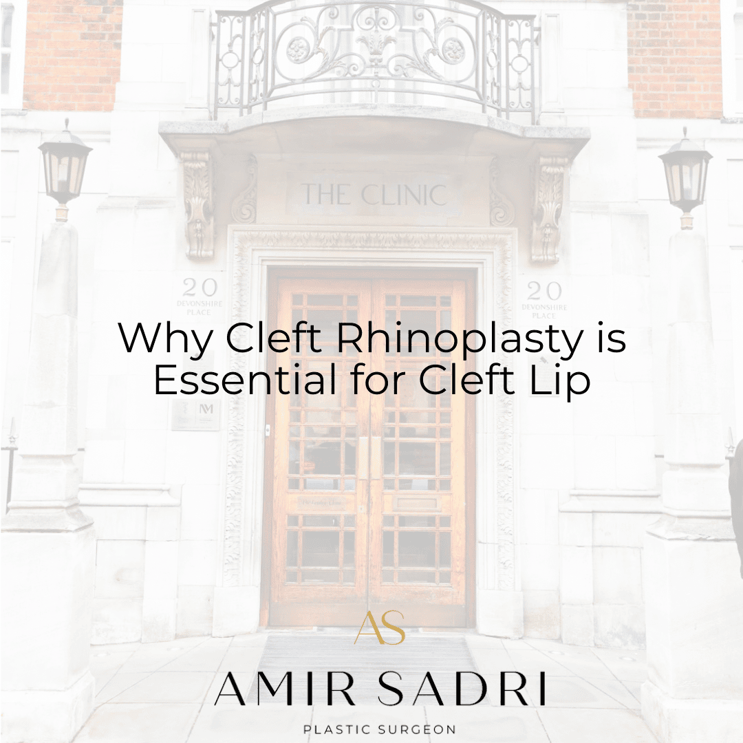 Why cleft rhinoplasty is essential for cleft lip