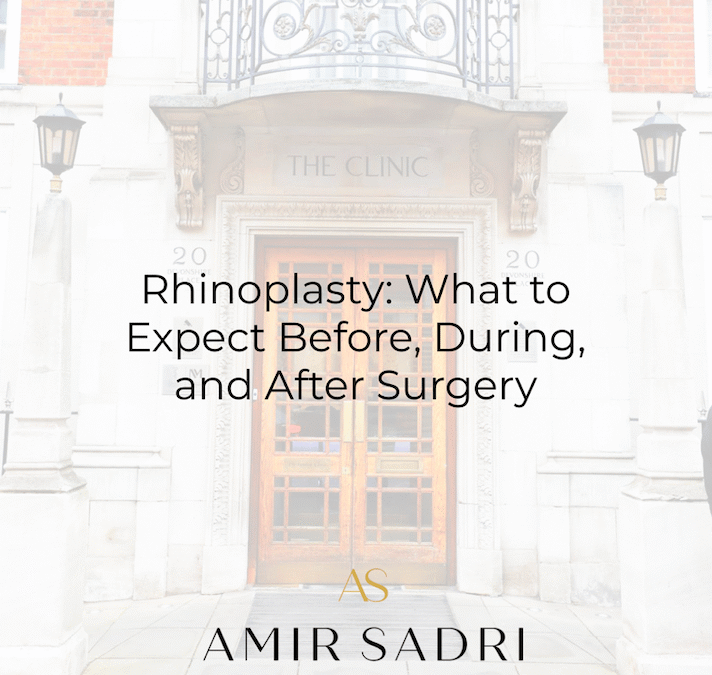 Rhinoplasty: What to Expect Before, During, and After Surgery