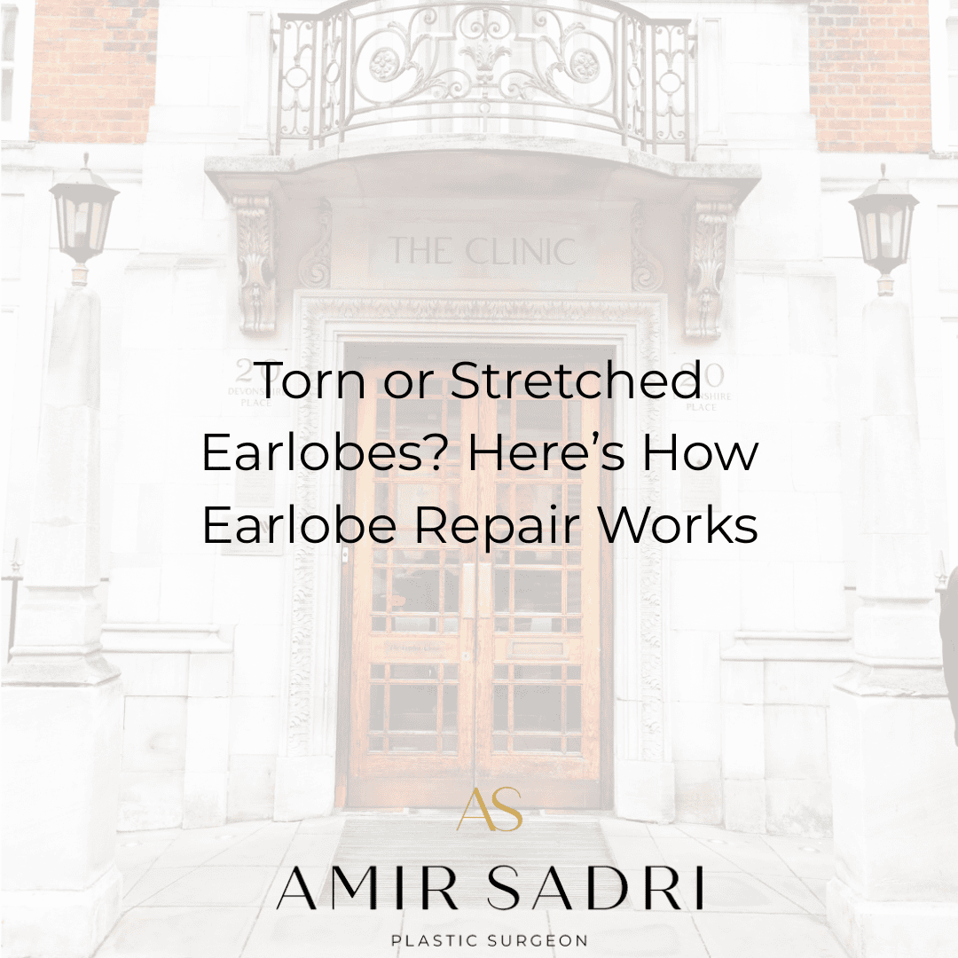 Torn or Stretched Earlobes? Here’s How Earlobe Repair Works