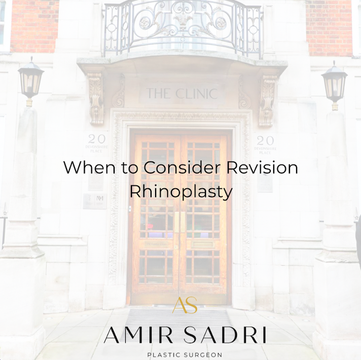 When to Consider Revision Rhinoplasty