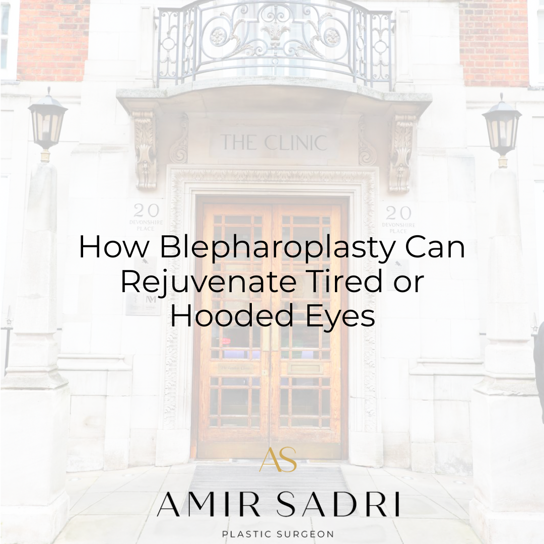 How Blepharoplasty Can Rejuvenate Tired or Hooded Eyes