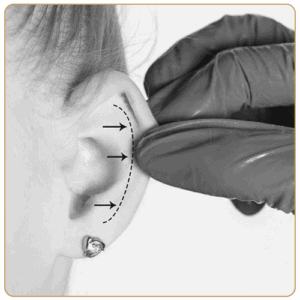 rhinoplasty plastic surgeon london. Facial plastic surgeon