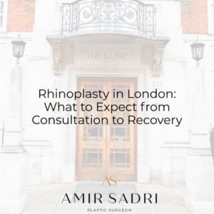 Rhinoplasty in London: What to Expect from Consultation to Recovery
