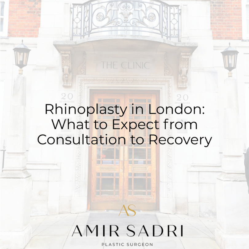 Rhinoplasty in London: What to Expect from Consultation to Recovery