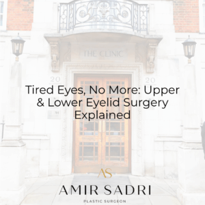 Tired Eyes, No More: Upper & Lower Eyelid Surgery Explained