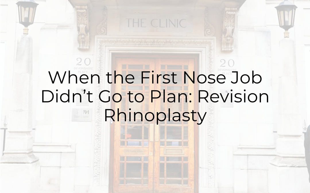When the First Nose Job Didn’t Go to Plan: Revision Rhinoplasty