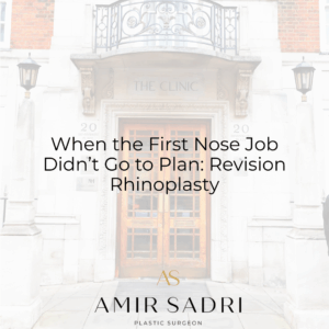 When the First Nose Job Didn’t Go to Plan: Revision Rhinoplasty