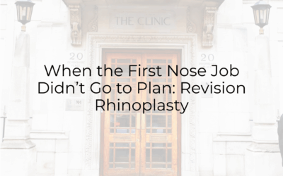 When the First Nose Job Didn’t Go to Plan: Revision Rhinoplasty